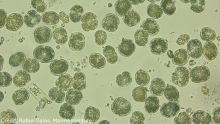Karenia mikimotoi cells