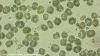 Karenia mikimotoi cells
